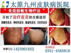 皮炎有哪些类型症状,对身体都有什么危害？